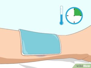 Как ускорить заживление ушиба — wikiHow